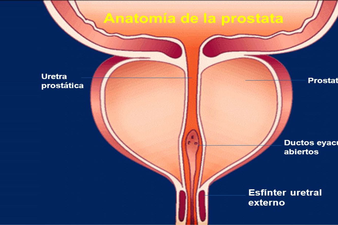 Prostata Operation Beste Klinik Baden Württemberg Anatomía de próstata