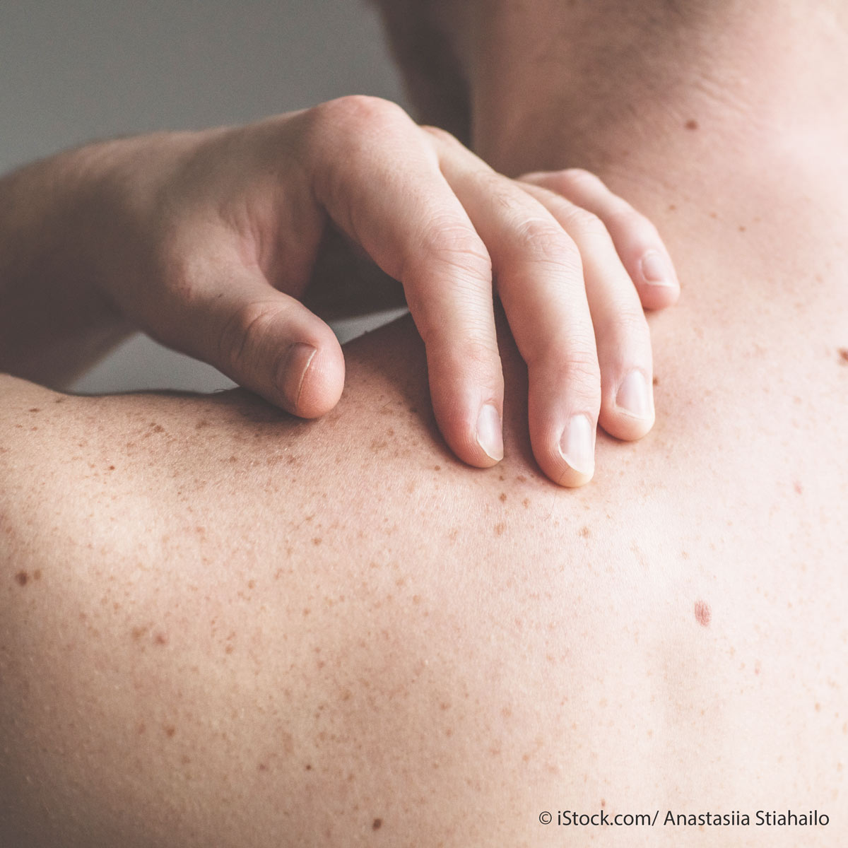 Haut Im Zentrum - Dermatologisches Fachärzteteam Die Haut - Aufbau und Funktion| Stiftung Gesundheitswissen