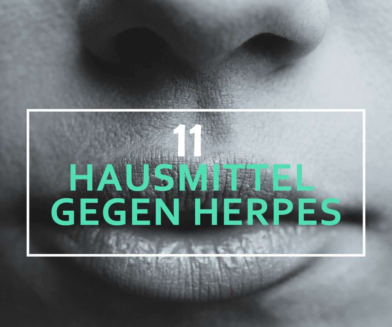 Ringelröteln Ab Wann Nicht Mehr Ansteckend Effective Treatments For Herpes
