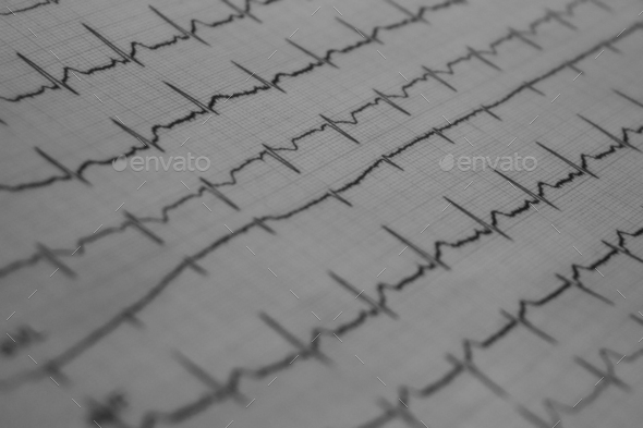 Kardiologen Im Umkreis Von 20 Km EKG von einem Kardiologen Stock Photo by wirestock | PhotoDune