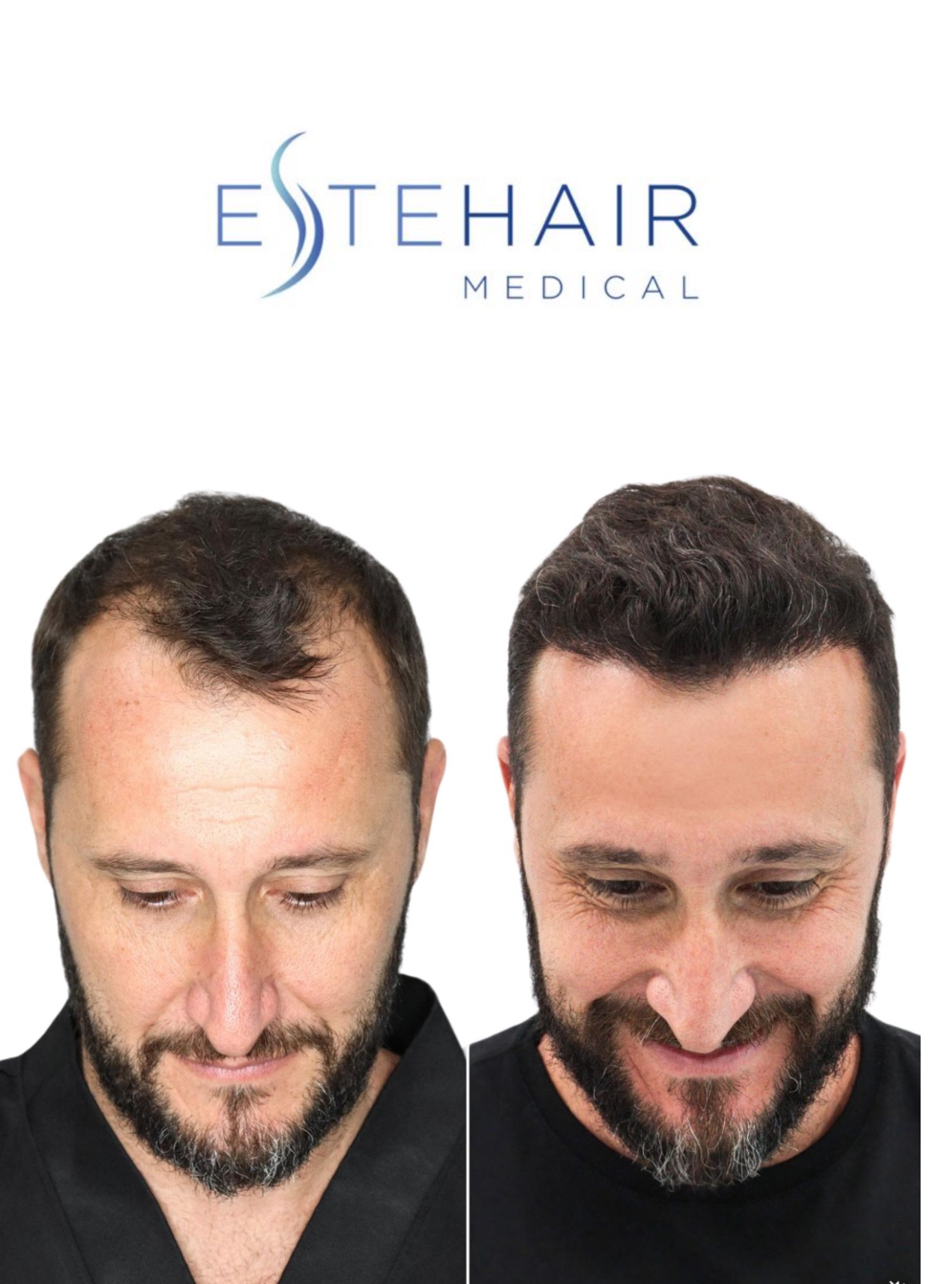 Rezensionen Für Friseur Pure More Than Hair Este Hair Medical – Non-Surgical Hair Restoration & Skin Care Treatments