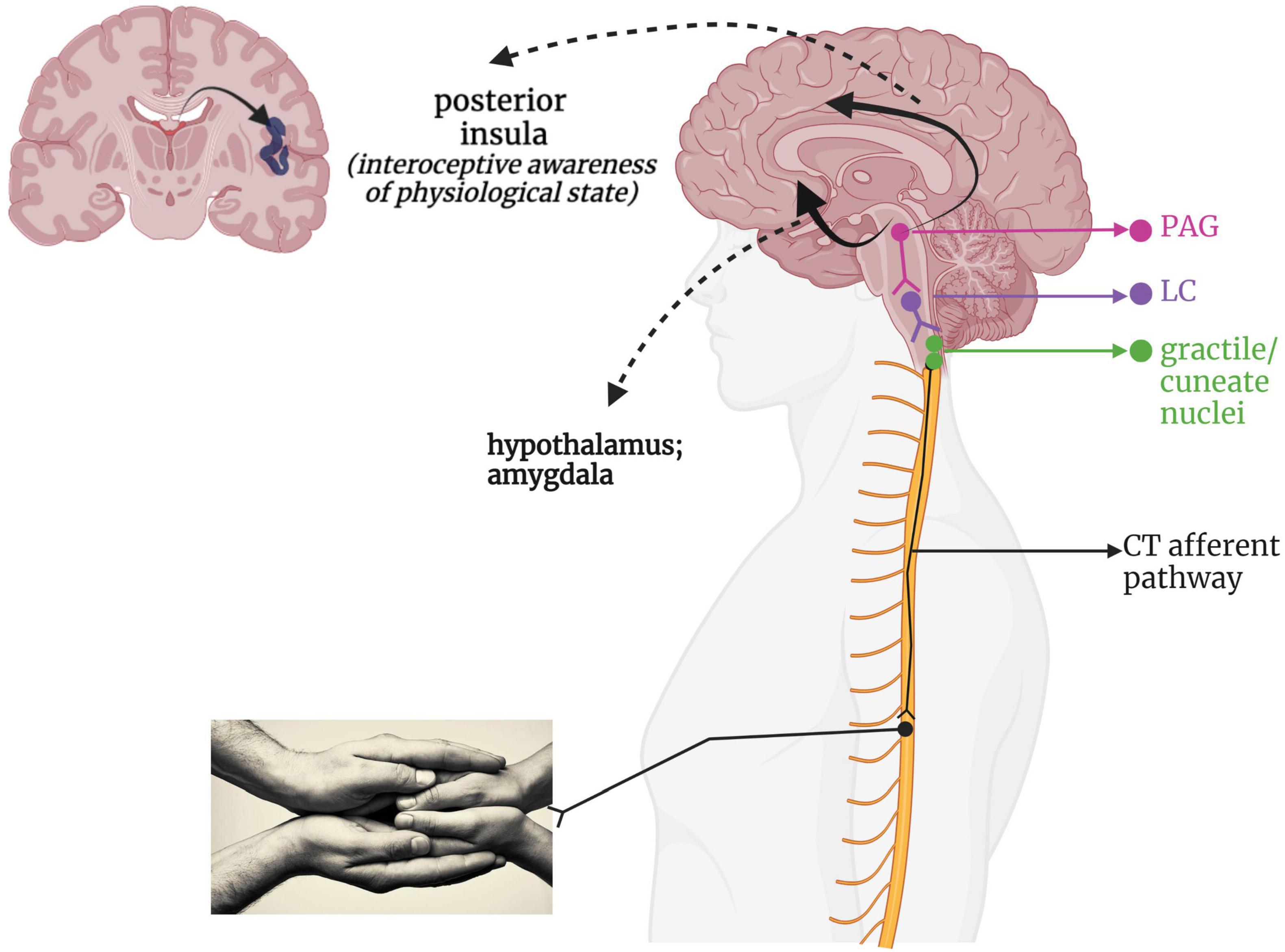 Ringelröteln Das Gleiche Wie Röteln Frontiers The Brain-body Disconnect: A Somatic Sensory, 47% OFF