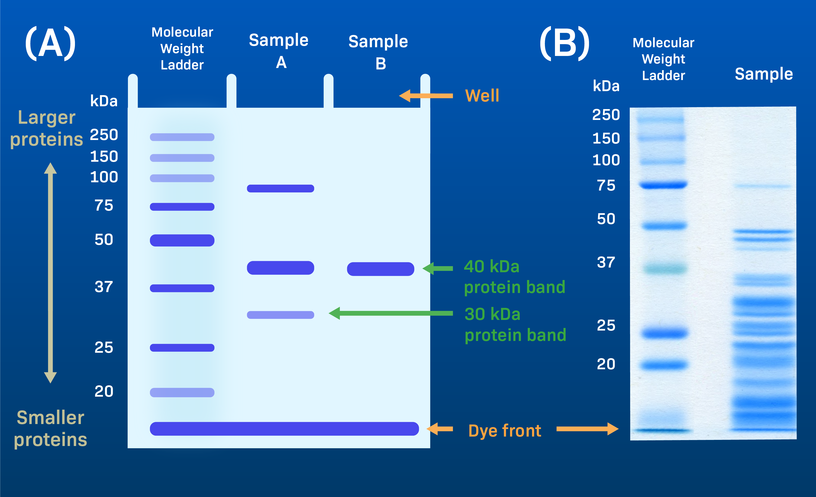 Pediküre Mit Gel In Der Nähe Gel Electrophoresis Diagram Labeled | The Best Porn Website