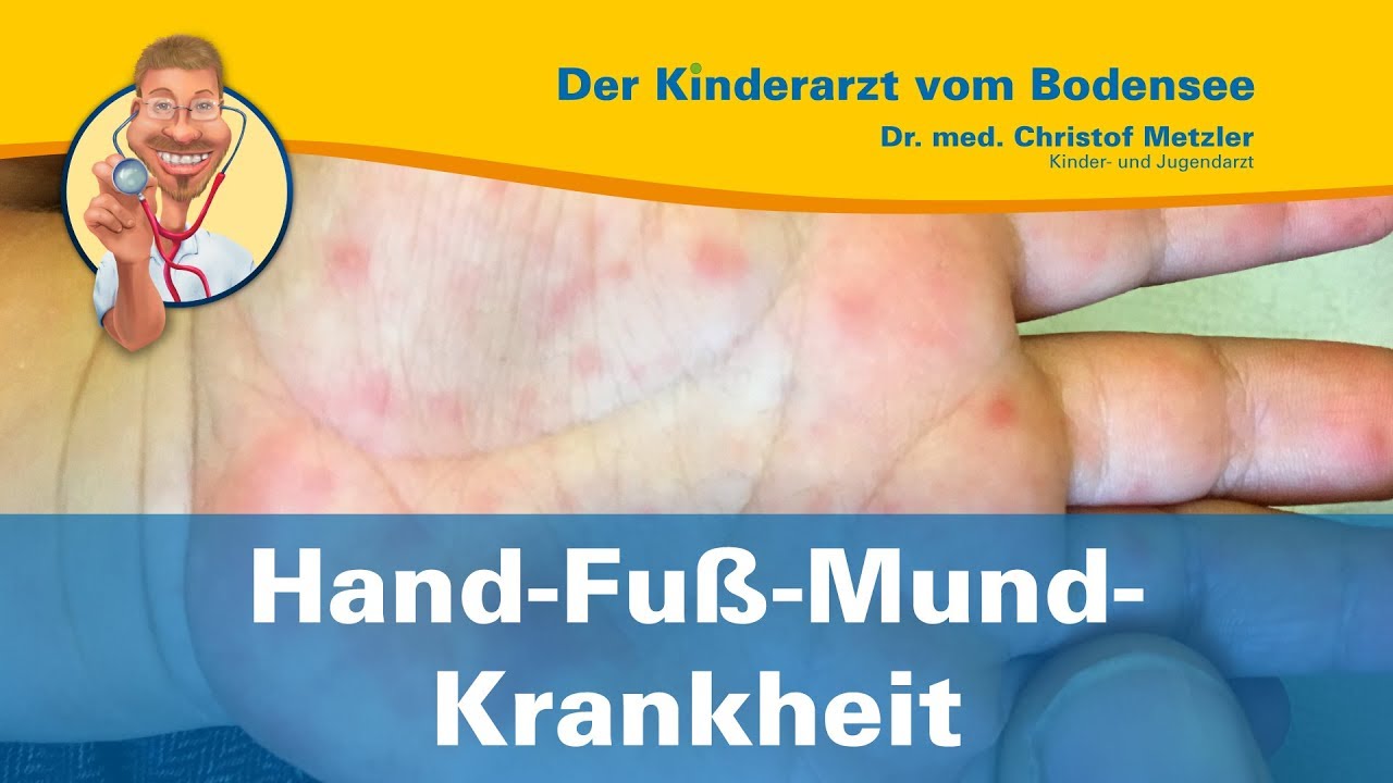 Hand Mund Fuß Krankheit Ansteckungsdauer Hand-Fuß-Mund-Krankheit - Der Kinderarzt vom Bodensee - YouTube