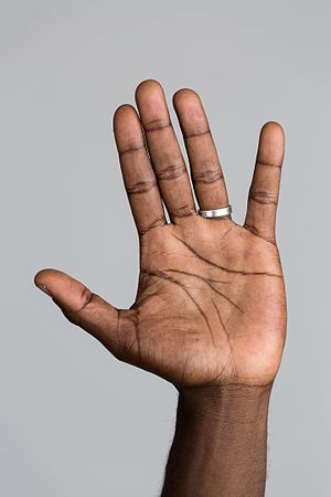 Hand Mund Fuß Nicht Mehr Ansteckend Hand - Wikipedia