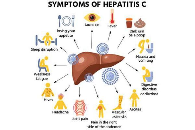 Wie Schlimm Ist Hep C Hepatiis C - MEDizzy
