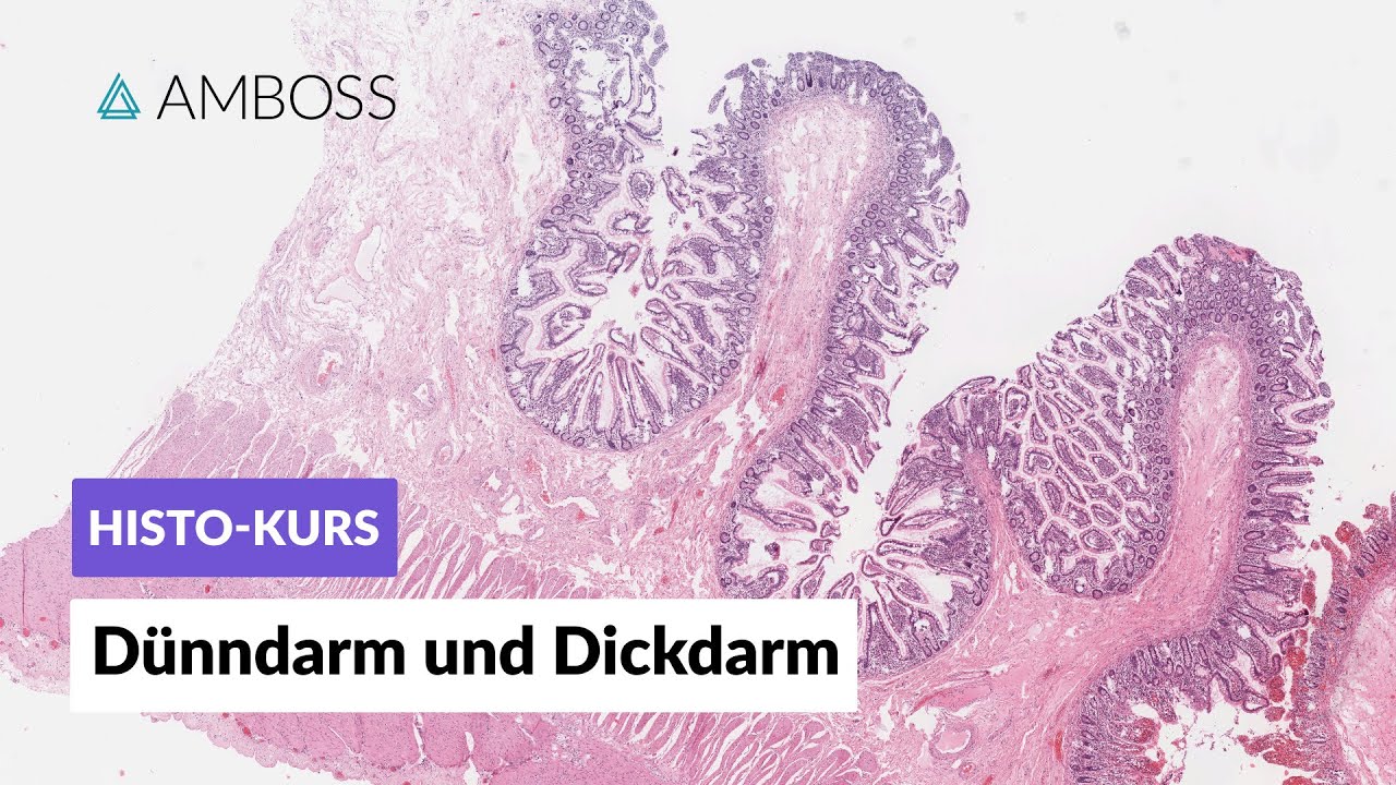 Rezensionen Für End- Und Dickdarm-zentrum Mannheim Edz Histologie Dünndarm und Dickdarm - Mikroskopische Anatomie - AMBOSS