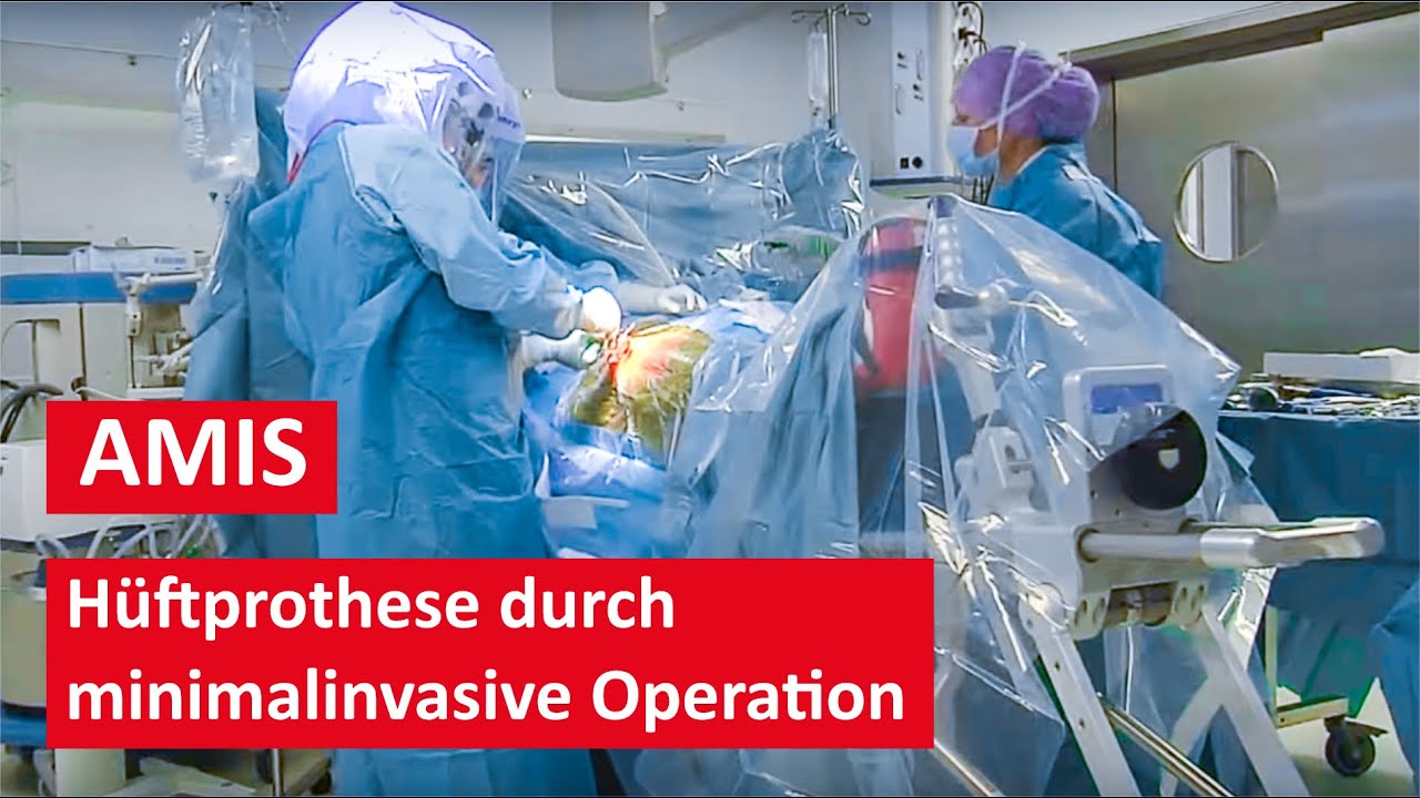 Welche Rehaklinik Nach Knie-op In Nrw Hüftprothese durch minimalinvasive AMIS Methode - Live Operation - YouTube