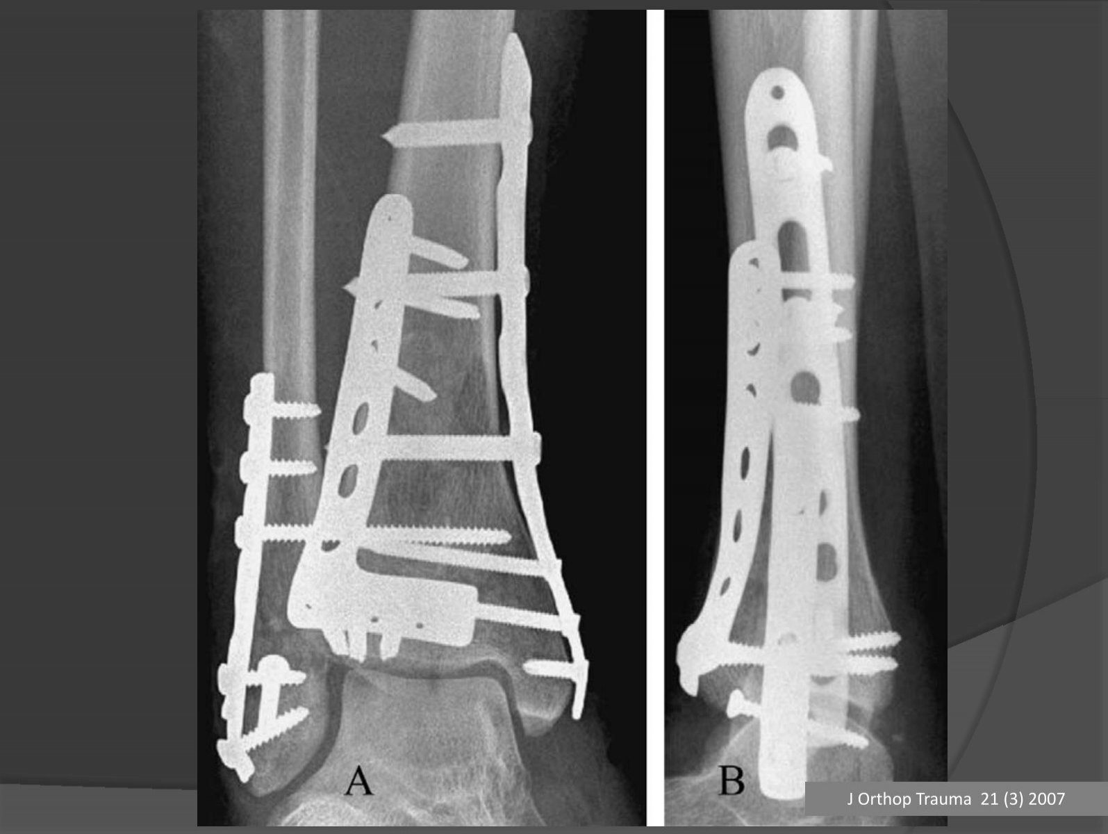 Chirurgische + Orthopädische Gemeinschaftspraxis - Garbsen - Hannover J Orthop Trauma 21 (3) 20