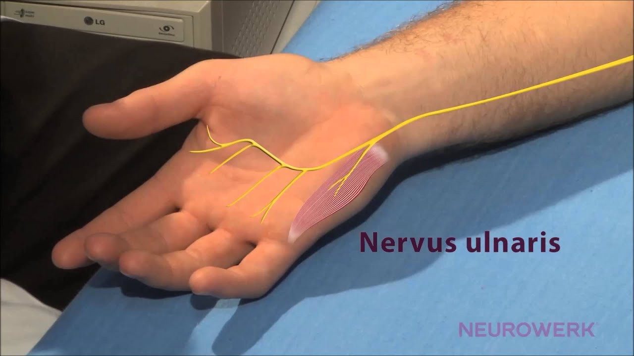 Orthopäde Für Schulter In Der Nähe Motorische Neurographie - Ulnaris - YouTube