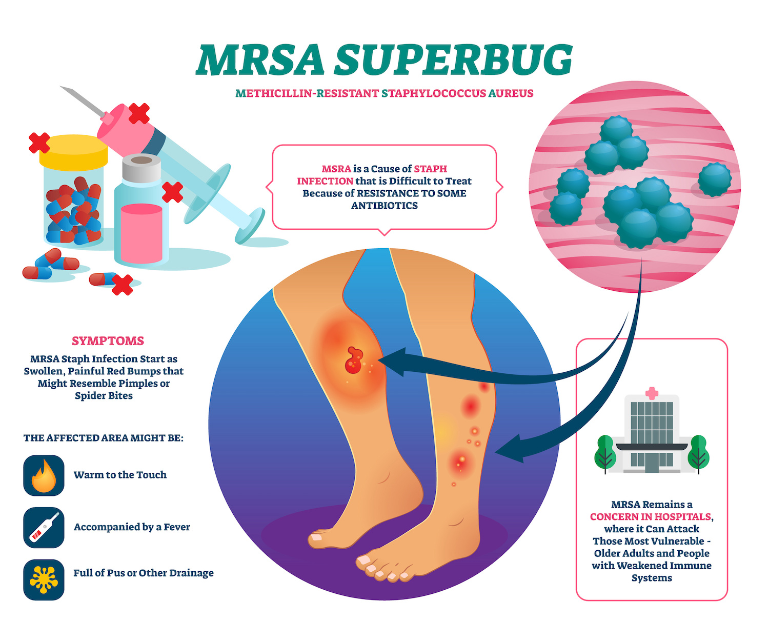 Darf Ich Mit Mrsa Arbeiten Gehen MRSA Infections in Nursing Homes & Care Living Facilities