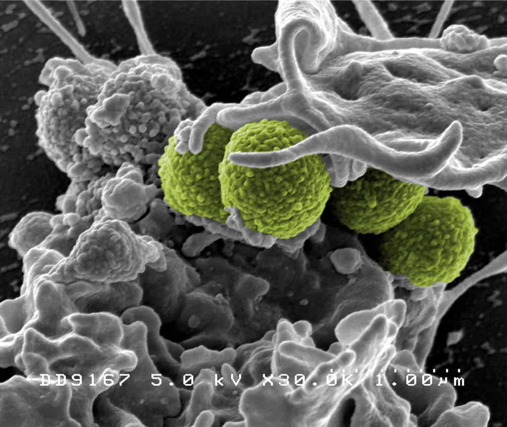 Hygienemaßnahmen Bei Mrsa Im Pflegeheim
