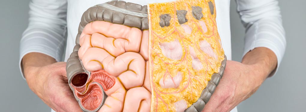 Mvz Gastroenterologie Oberhausen Gmbh - Prof. Schwerdtfeger Und Kollegen MVZ | MVZ Klinikum Esslingen