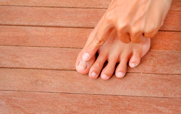 Anfangsstadium Hand Fuß Mund Krankheit Nagelpilz – wie sieht das Anfangsstadium aus?