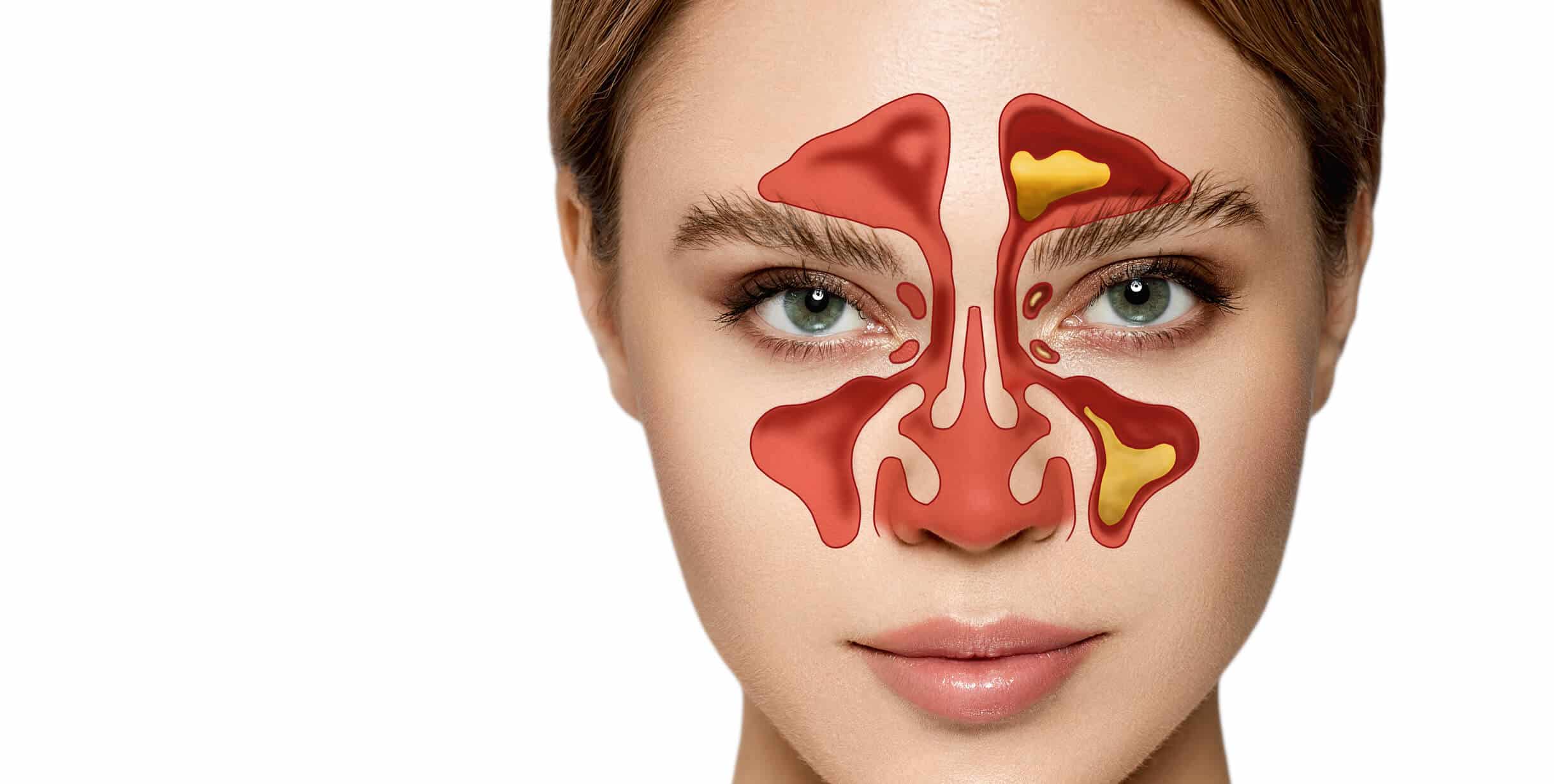 Sinus Und Kosinus Im Einheitskreis Nasal and Sinus Surgery for Chronic Sinusitis Relief