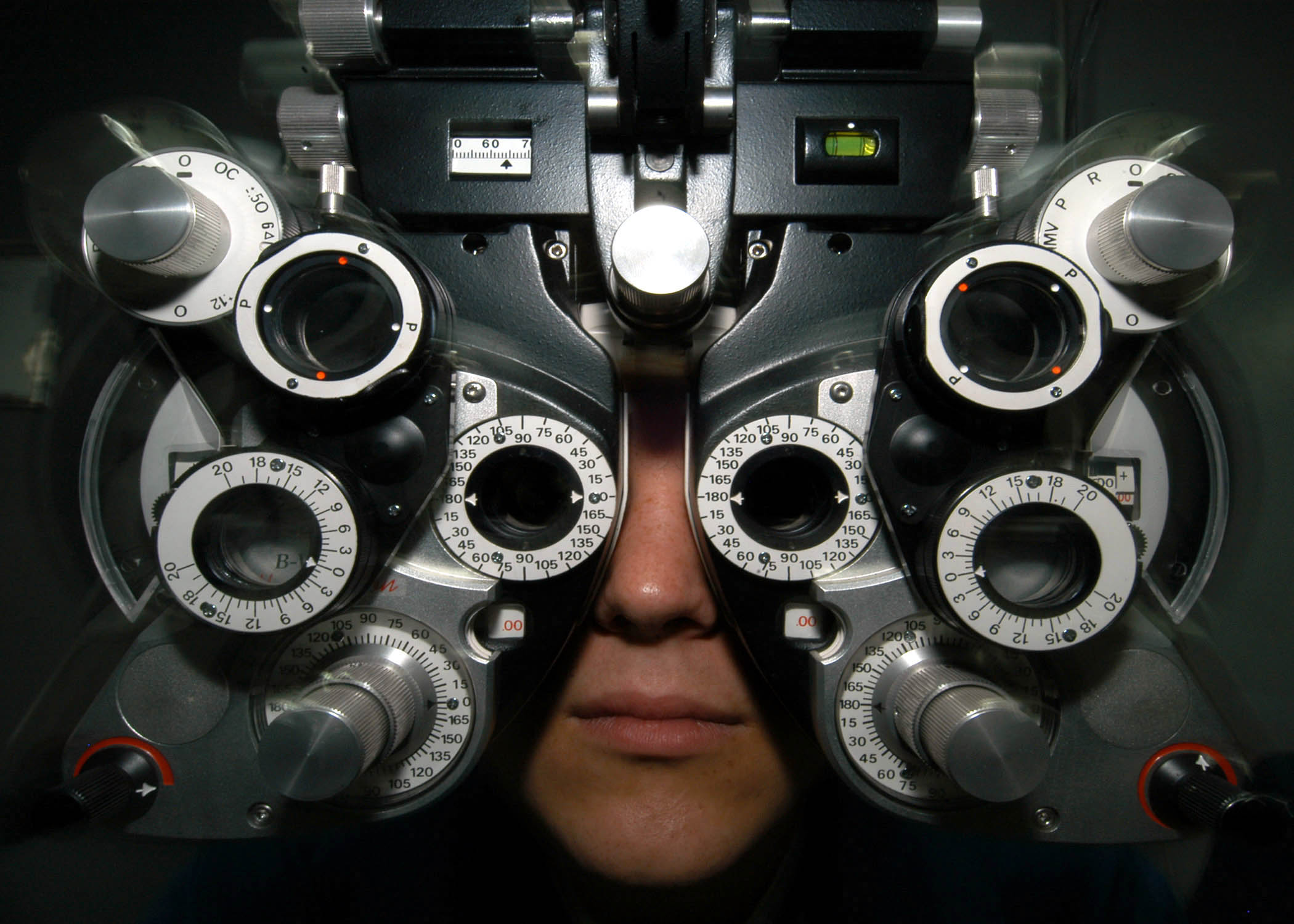 Eyes + More - Optiker Kaiserslautern Ophthalmology - wikidoc