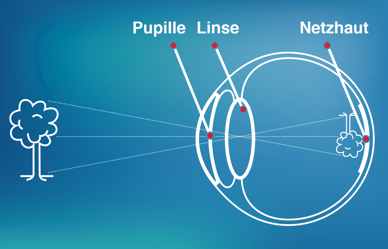 Optik Jahn Bergisch Gladbach Hörakustik & Optiker Optisches System des Auges | QAN