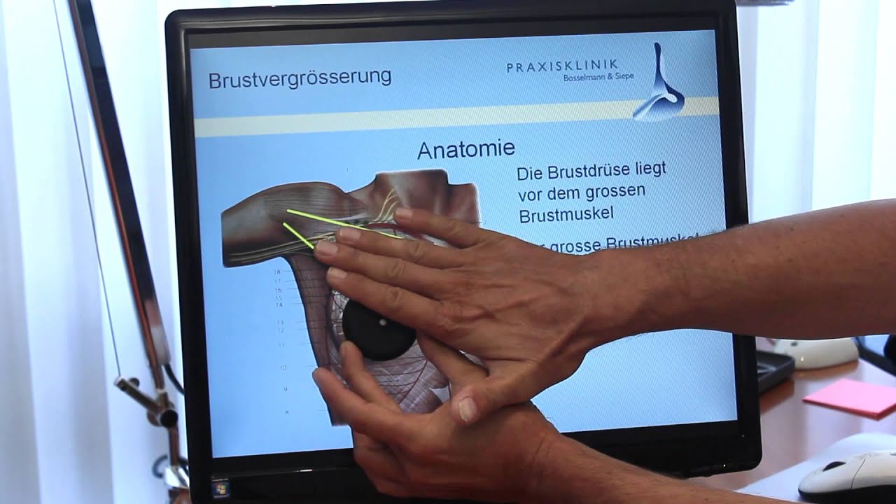Plastische Chirurgie In Bielefeld - Praxisklinik Dr. Blesse Plastischer Chirurg Bonn: Praxisklinik Dr. Bosselmann & Dr. Siepe - YouTube