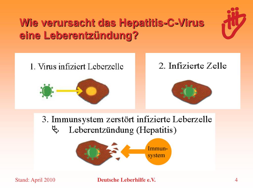 Hepatitis C Was Ist Das