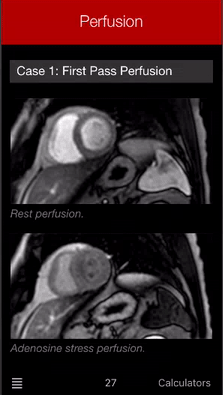 Dres. A. Kilhey & Ch. Harbecke ärzte Für Innere Medizin Radiologia en Internet: CMR Guide and CMR Pocket Guide