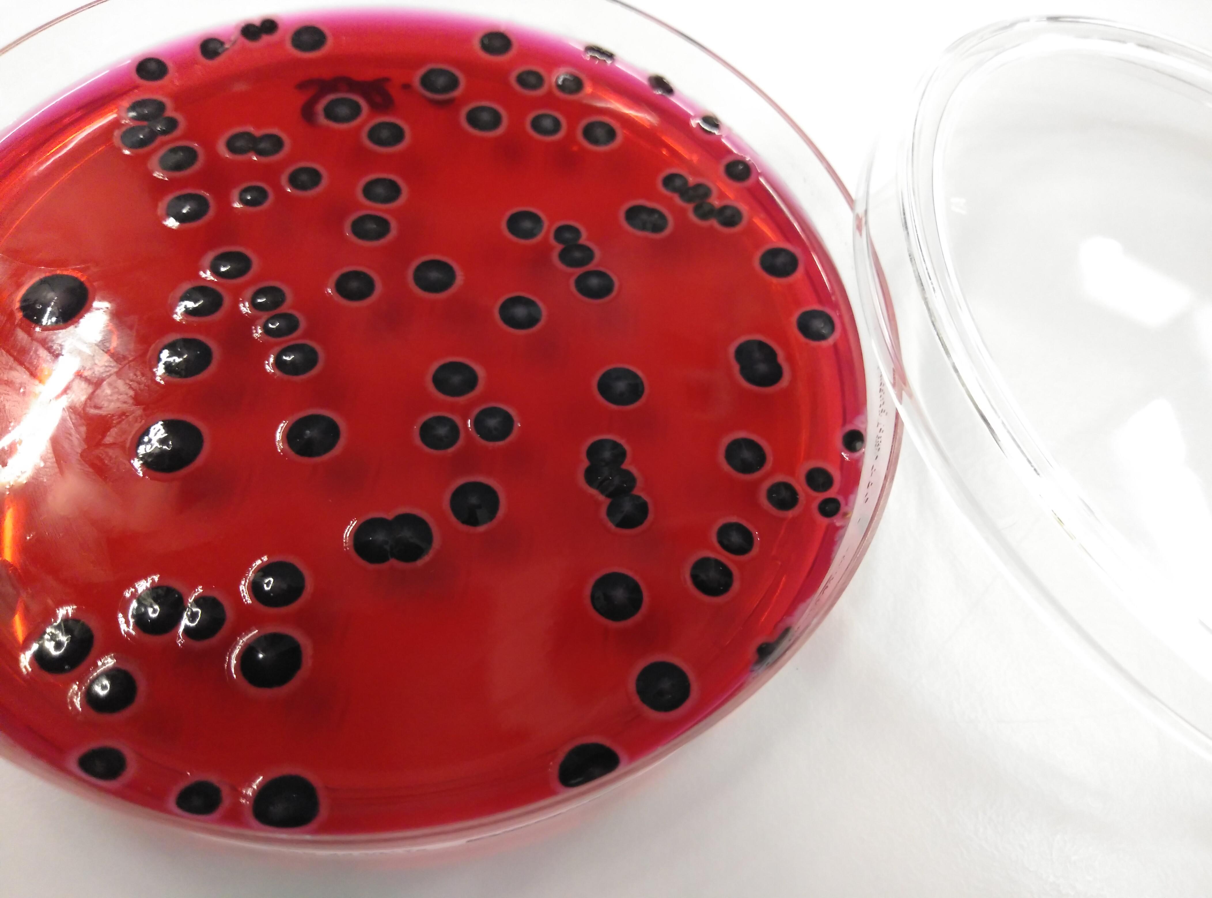 Wie Lange überleben Salmonellen Auf Oberflächen Salmonella Xld Salmonella On Xld Agar Close Up Salmonella Colony