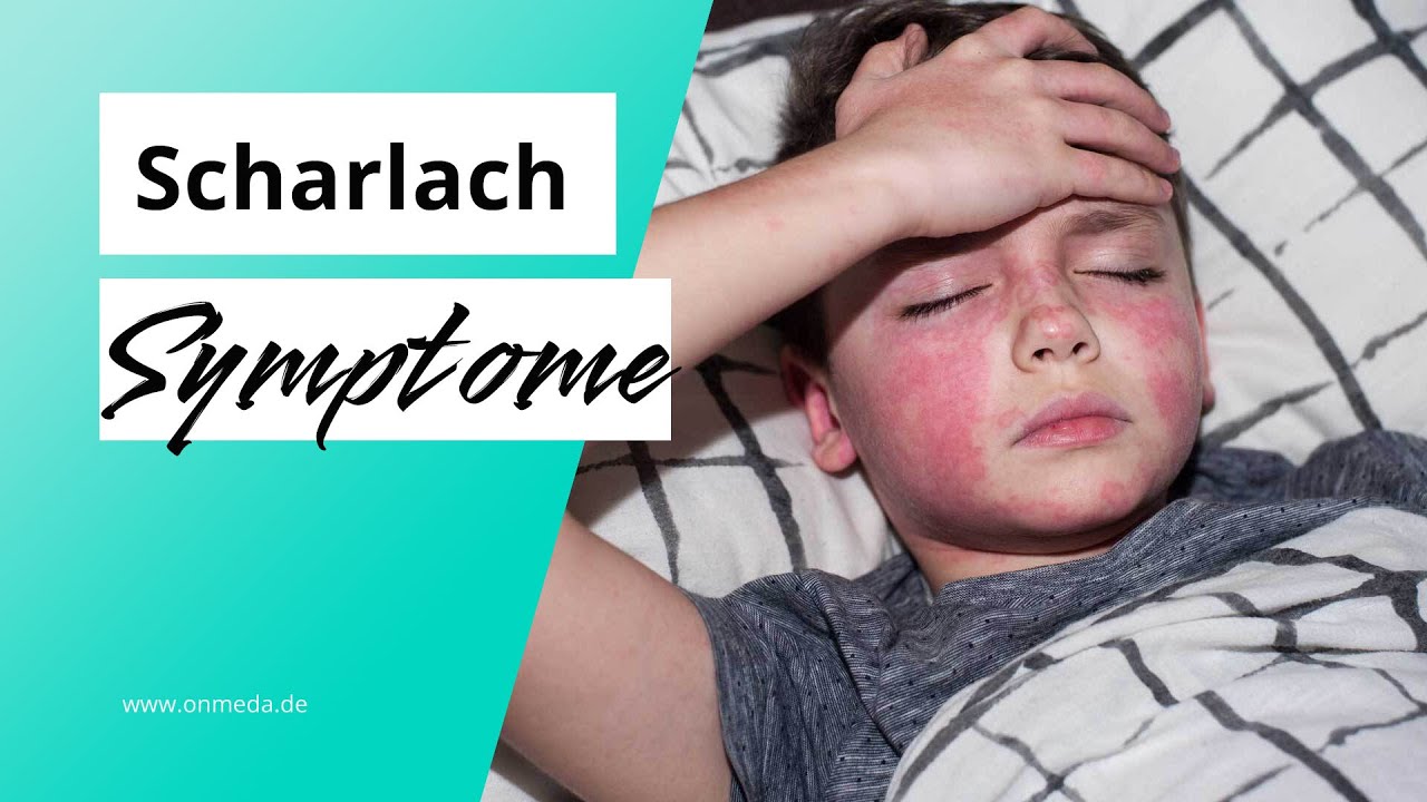 Ist Scharlach Ansteckend Für Erwachsene Scharlach: Das sind typische Symptome - YouTube