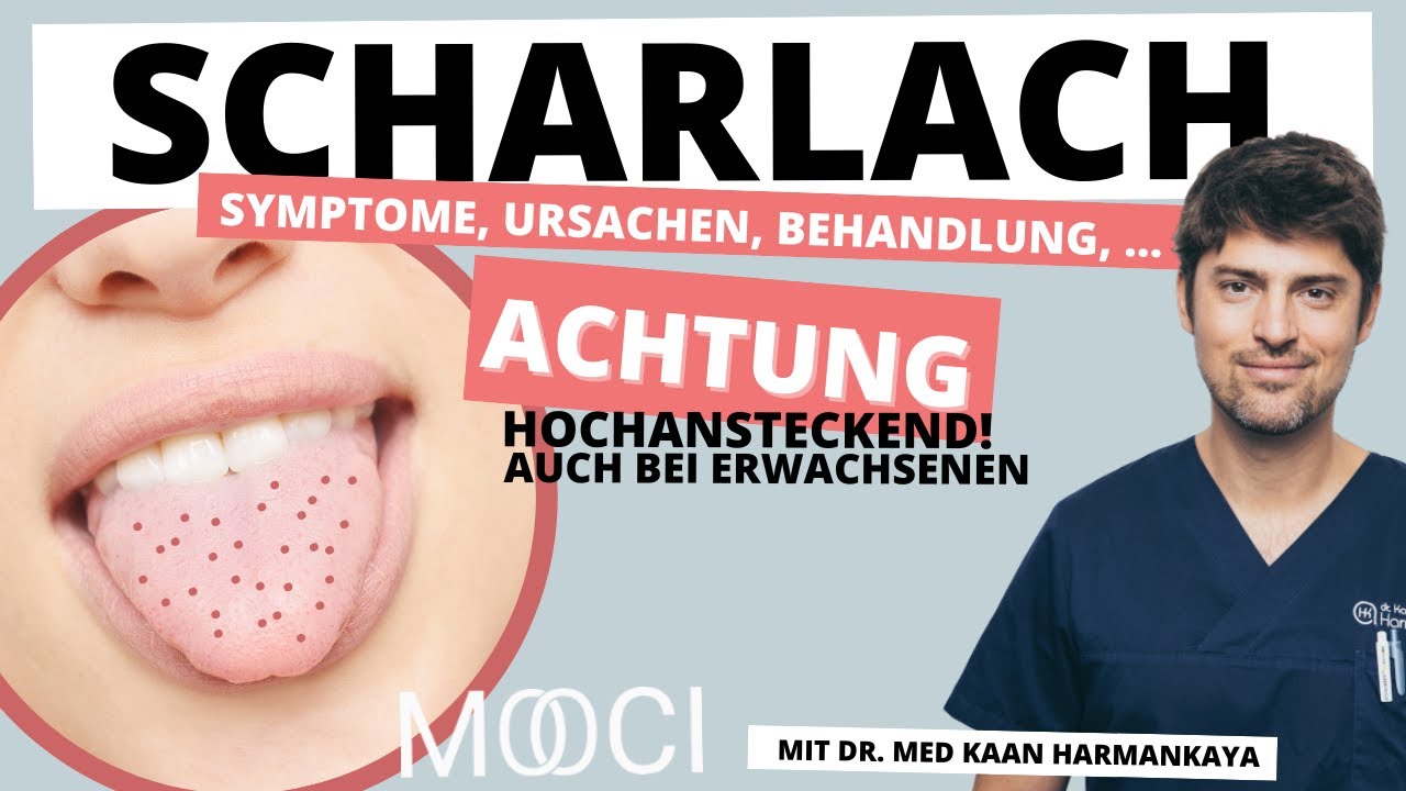 Ist Scharlach Ansteckend Für Erwachsene Scharlach 👅 Ursache, Symptome, Behandlung! - YouTube