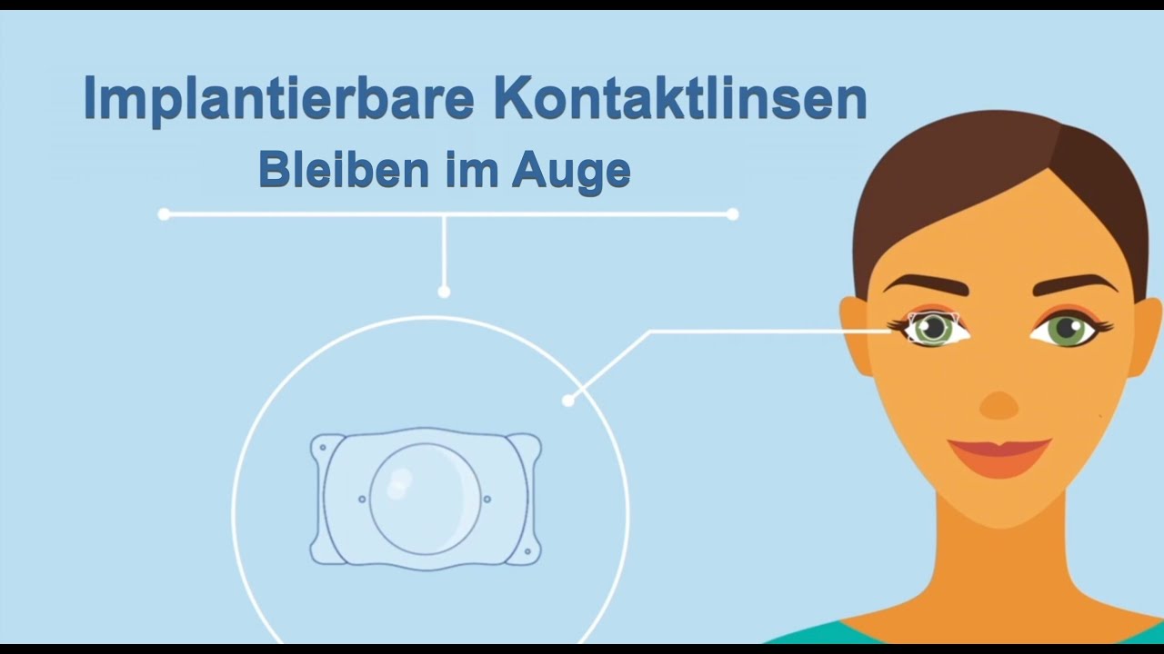 Frenz Fürs Auge Brillen Und Kontaktlinsen