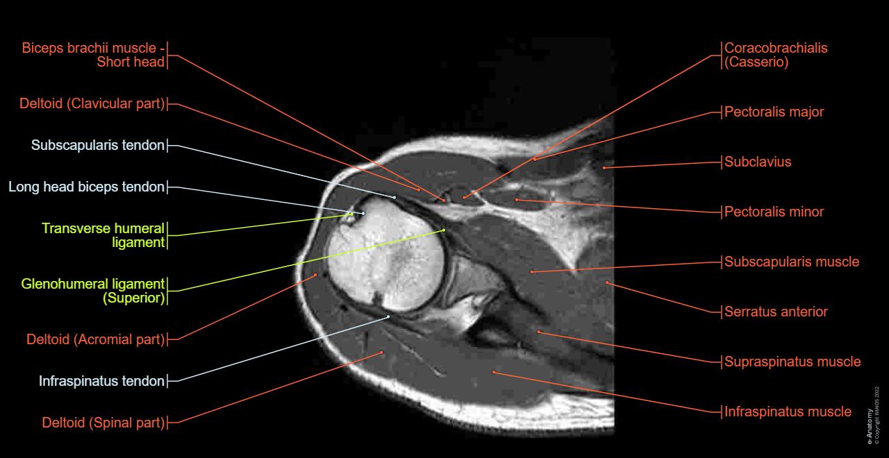 Orthopäde Mit Mrt In Der Nähe Shoulder MRI: normal anatomy | e-Anatomy