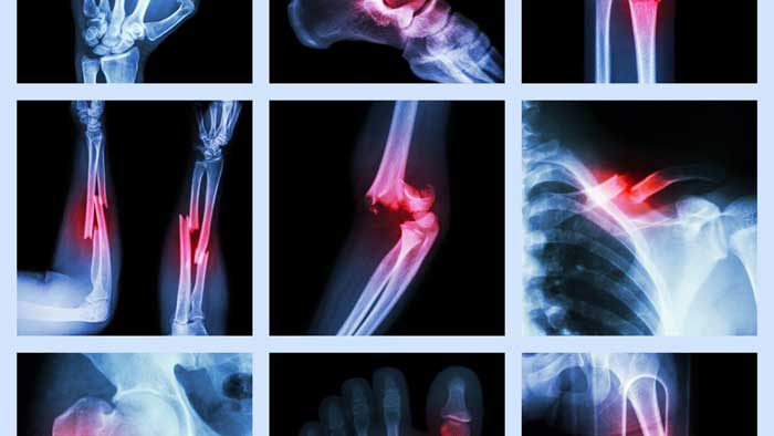 Rezensionen Für Orthopädie Und Unfallchirurgie Praxis Jürgen Engelmann Unfallchirurgie - Dr. J. H. Busch