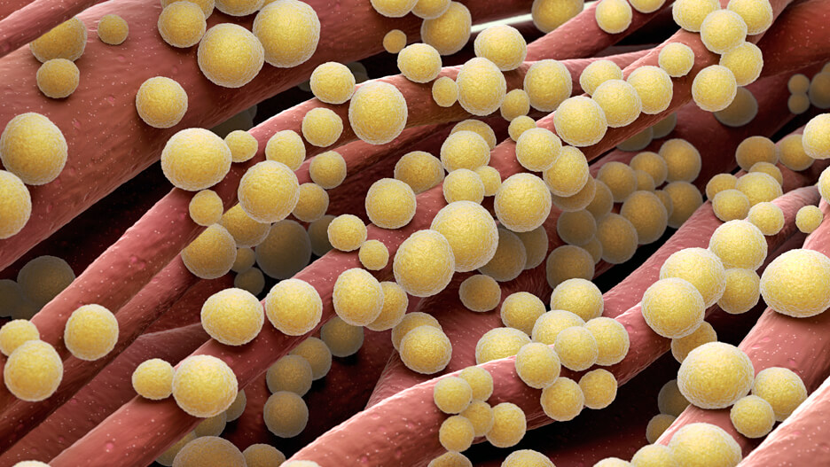 Rezensionen Für Zentrum Für Herz- Und Gefäßmedizin Mediapark Köln WAAW23 Fighting Staphylococcus aureus with HY-133 - HYpharm
