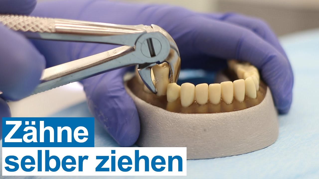 Lema Zahn- & Schönheitszentrum - Zahnarzt In Ingolstadt Zähne selber ziehen bei der Langen Nacht der Universitätsmedizin - YouTube